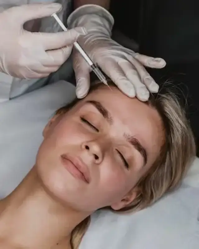 Botox facial preço