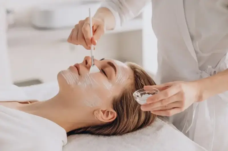 Peeling químico facial para manchas